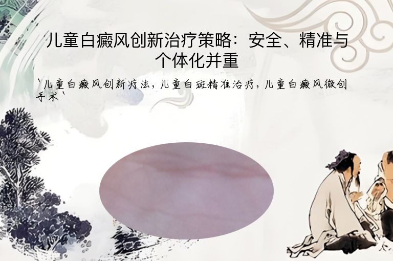 儿童白癜风创新治疗策略：安全、精准与个体化并重