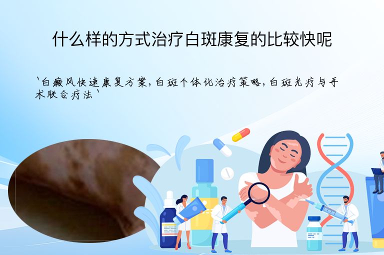 什么样的方式治疗白斑康复的比较快呢