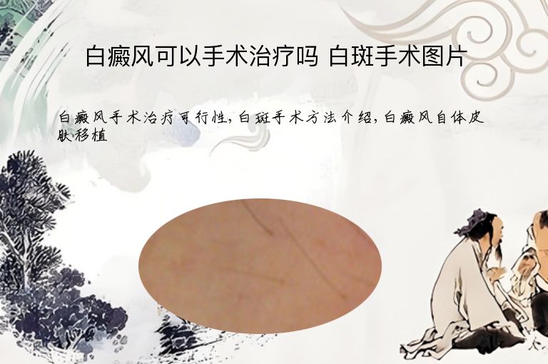 白癜风可以手术治疗吗 白斑手术图片”