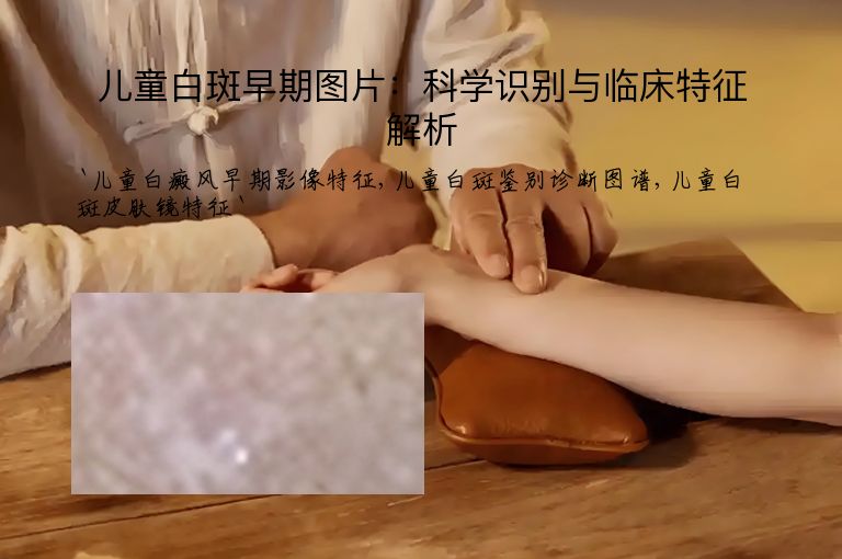 儿童白斑早期图片:科学识别与临床特征解析