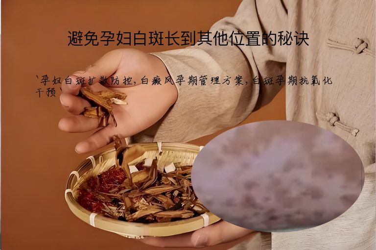 避免孕妇白斑长到其他位置的秘诀