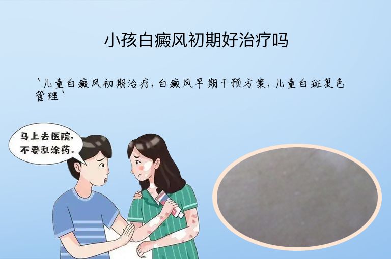 小孩白癜风初期好治疗吗
