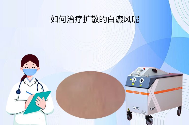 如何治疗扩散的白癜风呢”
