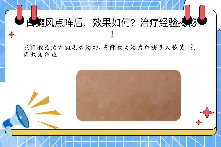 白癜风点阵后,效果如何?治疗经验揭秘!”