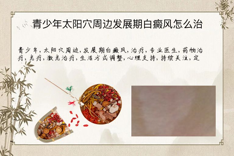 青少年太阳穴周边发展期白癜风怎么治”