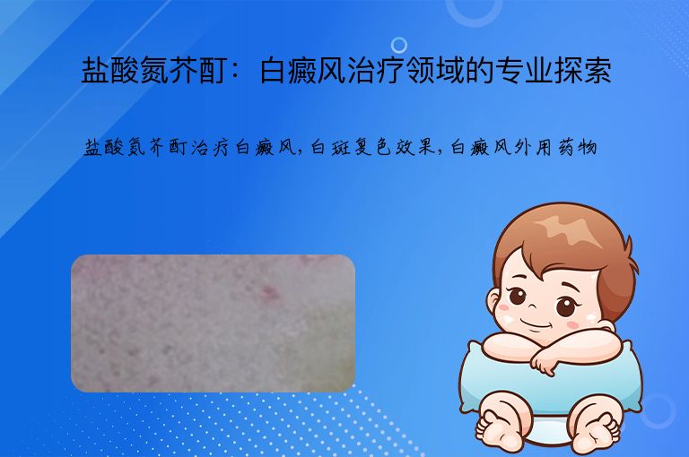 盐酸氮芥酊：白癜风治疗领域的专业探索”