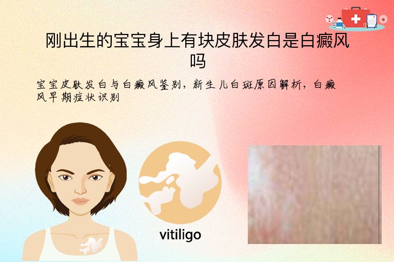 刚出生的宝宝身上有块皮肤发白是白癜风吗”