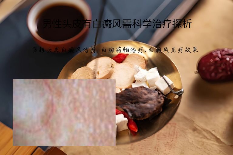 https://www.bdfsjzyy.com/d/file/p/9515262656c48410ead90cd7427cb054.jpeg