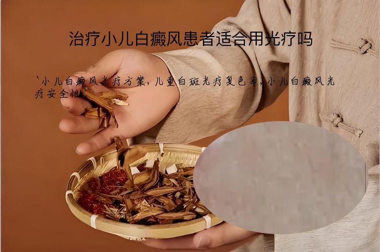 治疗小儿白癜风患者适合用光疗吗