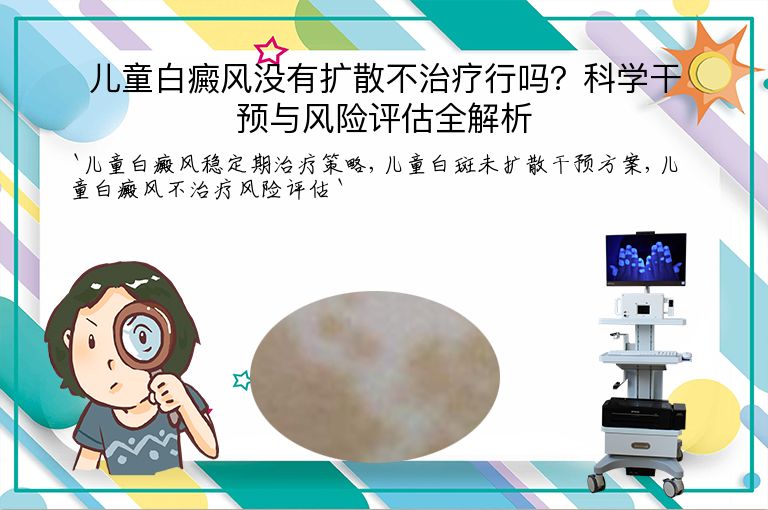 儿童白癜风没有扩散不治疗行吗?科学干预与风险评估全解析