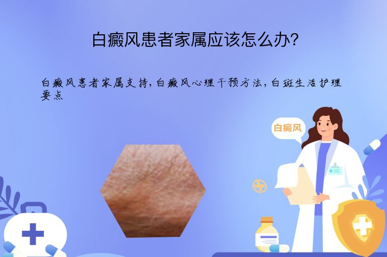 https://www.bdfsjzyy.com/d/file/p/5302f122e24b32510202c8535dac1288.jpeg