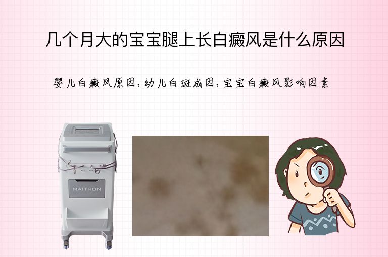 几个月大的宝宝腿上长白癜风是什么原因”