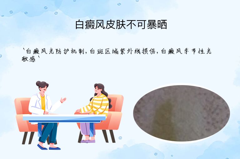 白癜风皮肤不可暴晒