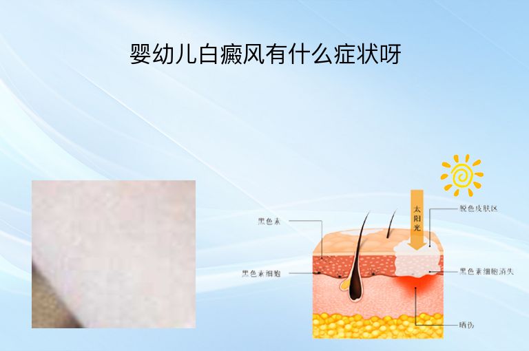 https://www.bdfsjzyy.com/d/file/p/65c596ec25243a18f754bf0ca1b165c1.jpeg