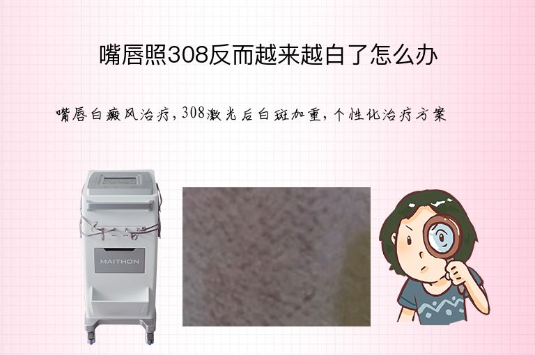 https://www.bdfsjzyy.com/d/file/p/384bd7ec286affe154f45a1845209e40.jpeg