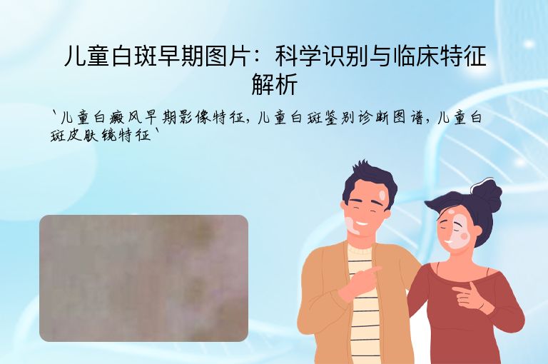 儿童白斑早期图片:科学识别与临床特征解析