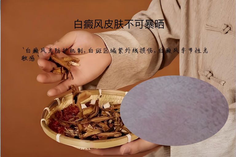 白癜风皮肤不可暴晒