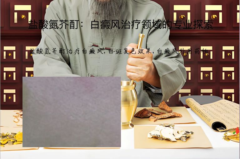 盐酸氮芥酊:白癜风治疗领域的专业探索”