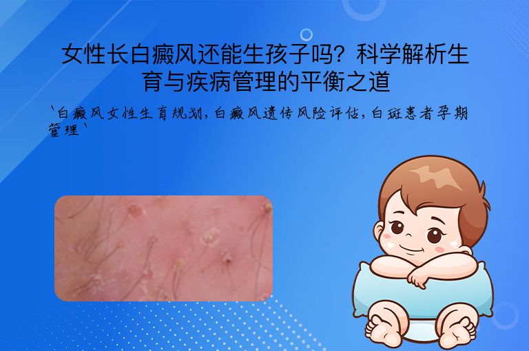女性长白癜风还能生孩子吗?科学解析生育与疾病管理的平衡之道”