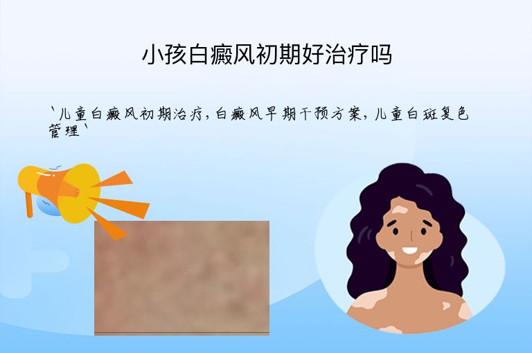 小孩白癜风初期好治疗吗