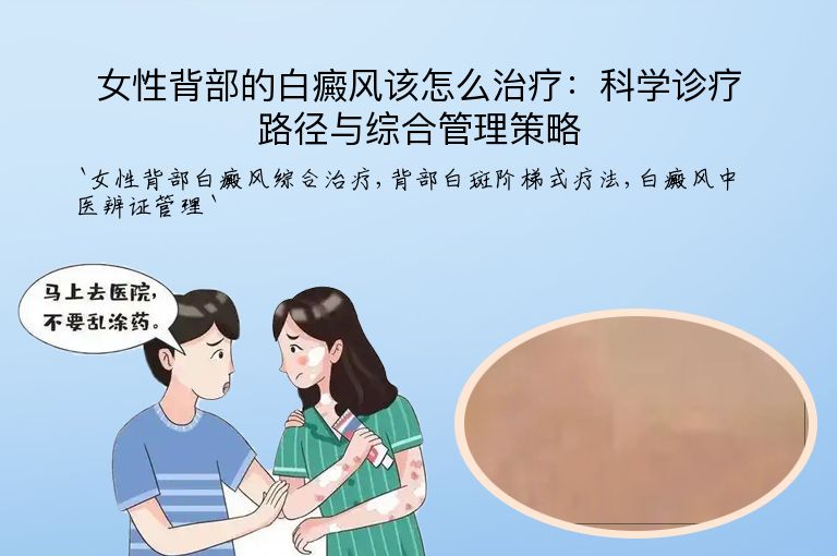 女性背部的白癜风该怎么治疗：科学诊疗路径与综合管理策略
