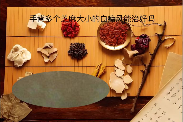 https://www.bdfsjzyy.com/d/file/p/f528a69fb1b3df947574a9505a40a91f.jpeg