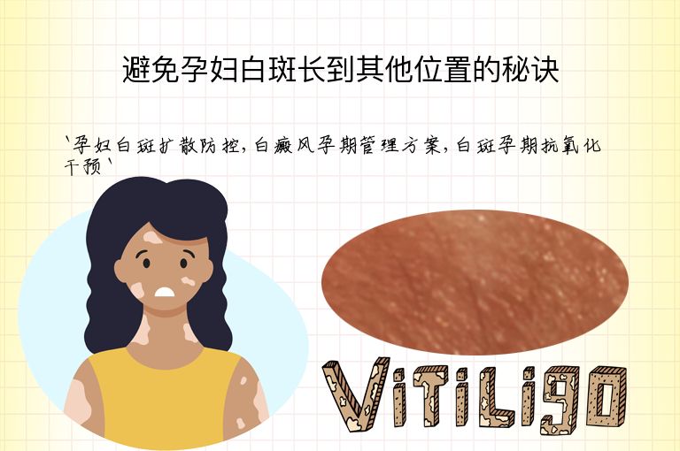 避免孕妇白斑长到其他位置的秘诀