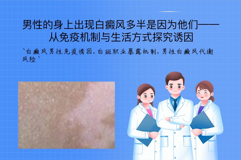 男性的身上出现白癜风多半是因为他们——从免疫机制与生活方式探究诱因