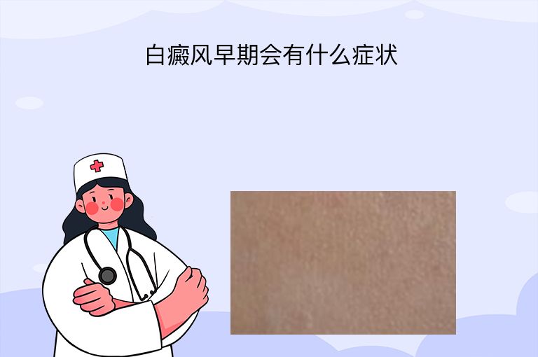 白癜风早期会有什么症状