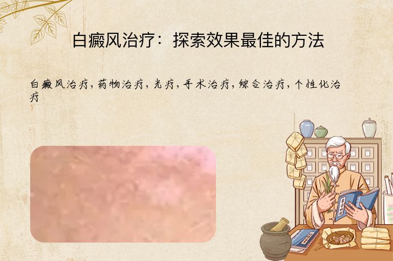 白癜风治疗：探索效果最佳的方法”