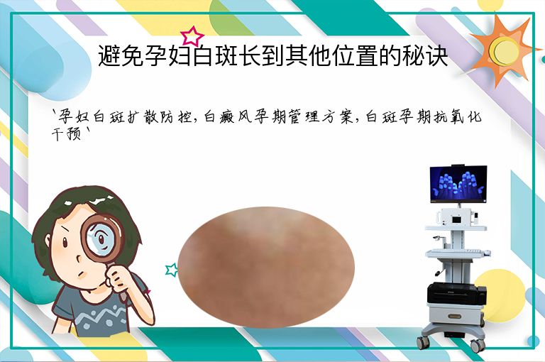 避免孕妇白斑长到其他位置的秘诀