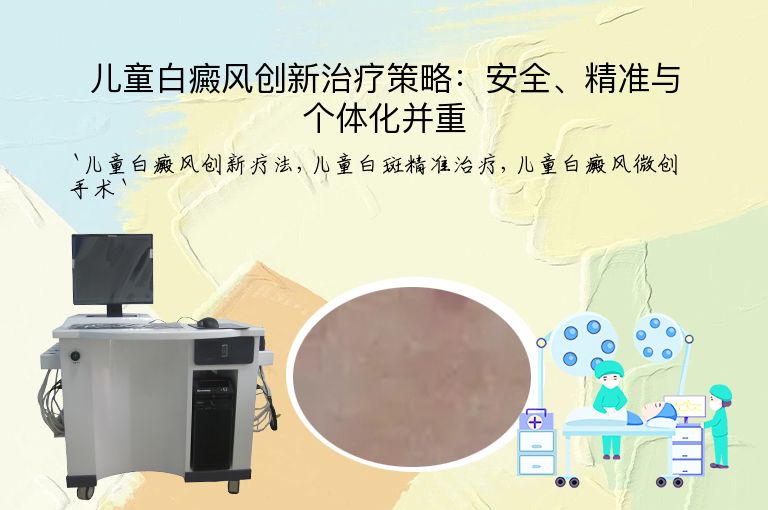儿童白癜风创新治疗策略:安全、精准与个体化并重