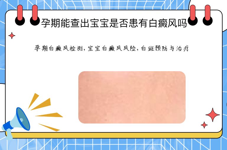 孕期能查出宝宝是否患有白癜风吗”