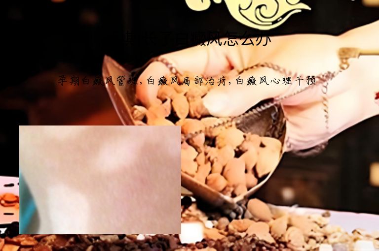 孕期长了白癜风怎么办”