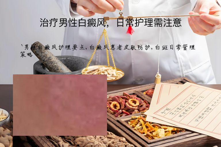 治疗男性白癜风，日常护理需注意