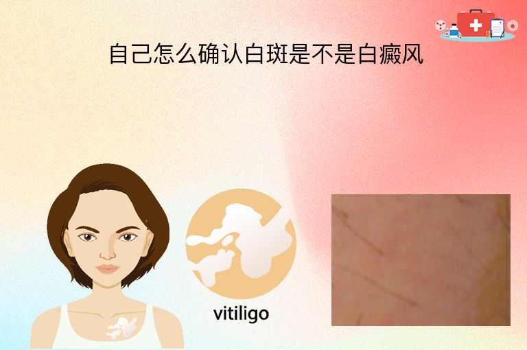 自己怎么确认白斑是不是白癜风”