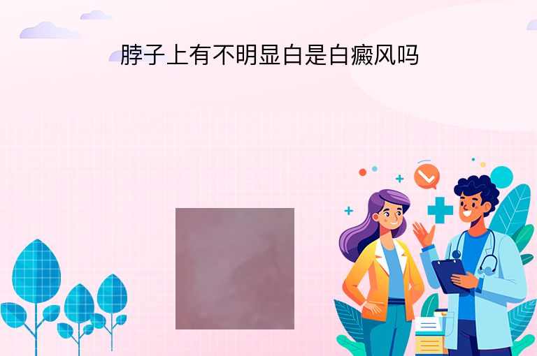 脖子上有不明显白是白癜风吗