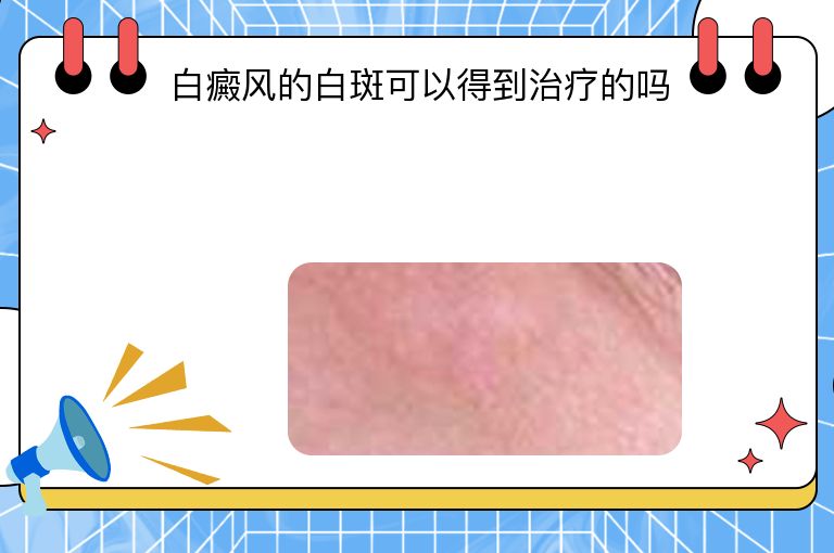 https://www.bdfsjzyy.com/d/file/p/033f3676c8544f22ac45f627ccb18fbb.jpeg