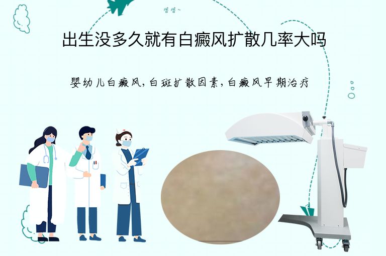出生没多久就有白癜风扩散几率大吗”