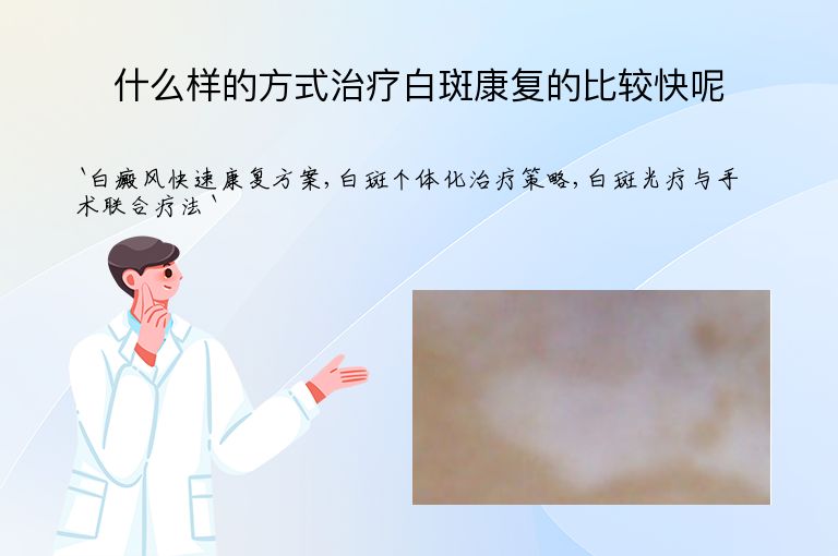 什么样的方式治疗白斑康复的比较快呢