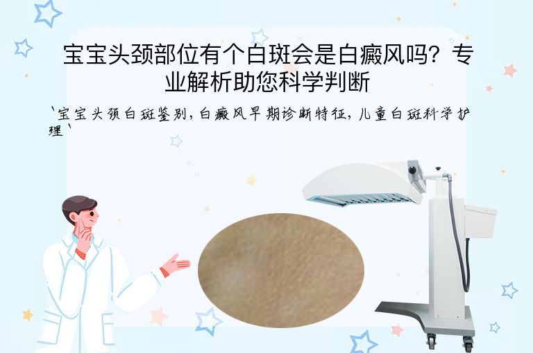 宝宝头颈部位有个白斑会是白癜风吗?专业解析助您科学判断”