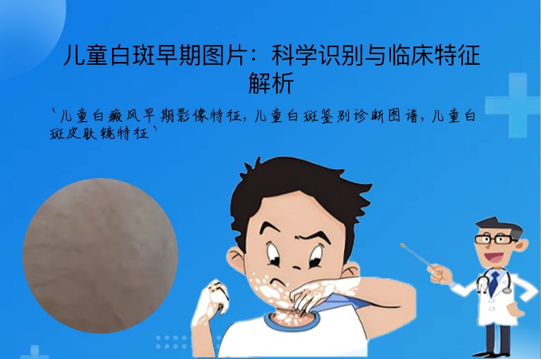 儿童白斑早期图片:科学识别与临床特征解析