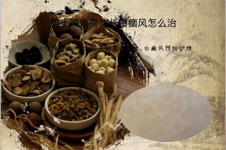 男士嘴角旁边长白癜风怎么治”