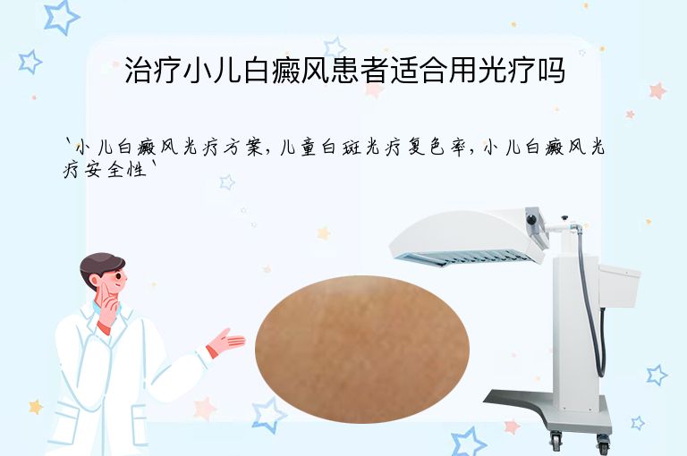 治疗小儿白癜风患者适合用光疗吗