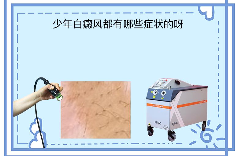 https://www.bdfsjzyy.com/d/file/p/21a90ef5215321d46eddb92af422fa91.jpeg