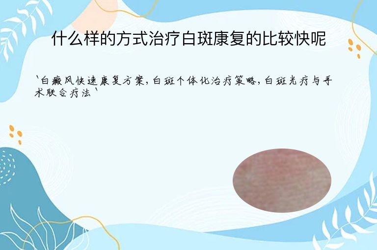 什么样的方式治疗白斑康复的比较快呢