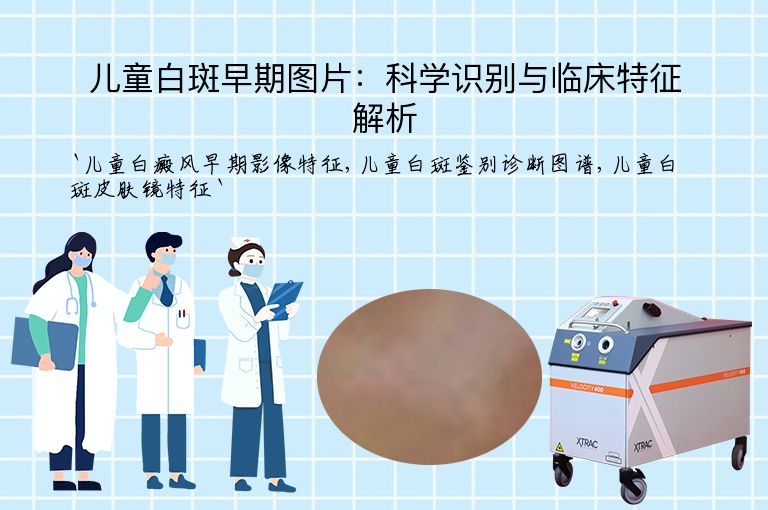 儿童白斑早期图片：科学识别与临床特征解析