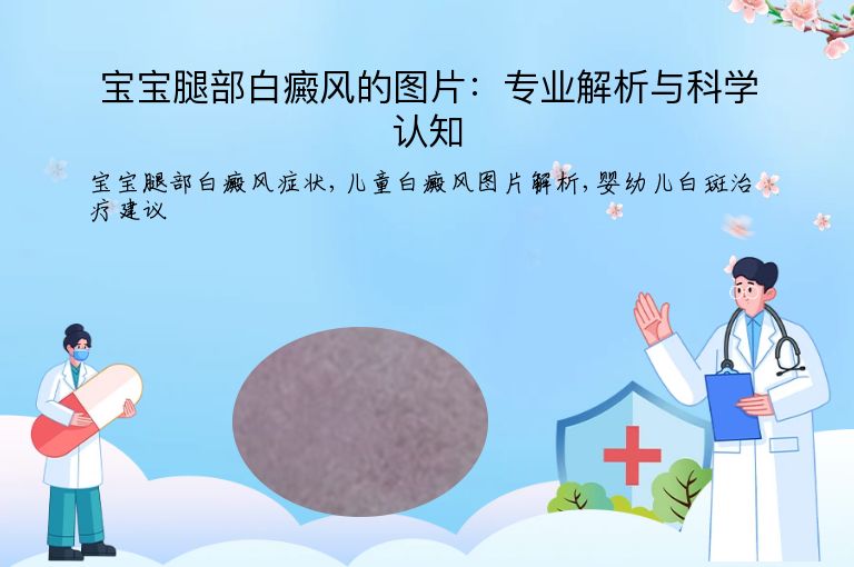 宝宝腿部白癜风的图片：专业解析与科学认知”