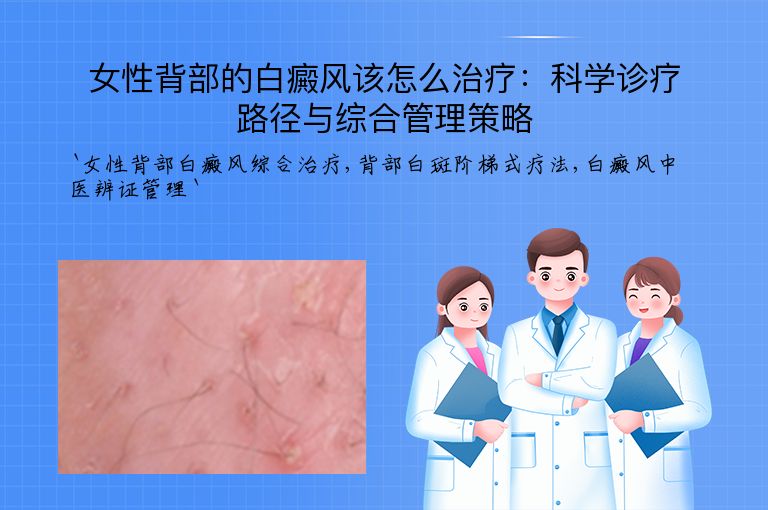 女性背部的白癜风该怎么治疗：科学诊疗路径与综合管理策略