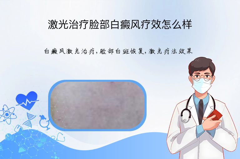 激光治疗脸部白癜风疗效怎么样”